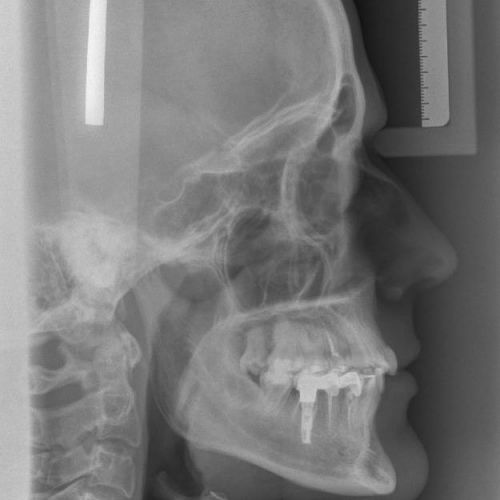 Telerradiografía